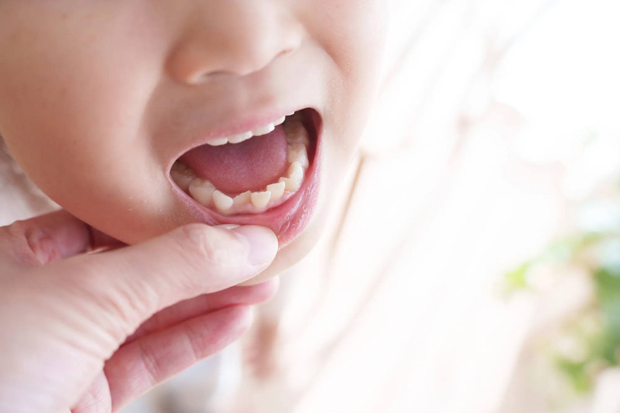 子どもの虫歯はなぜできる?原因と予防方法をわかりやすく解説|桑園で小児歯科をお探しの方へ 子どもの虫歯はなぜできる?原因と予防方法をわかりやすく解説|桑園で小児歯科をお探しの方へ